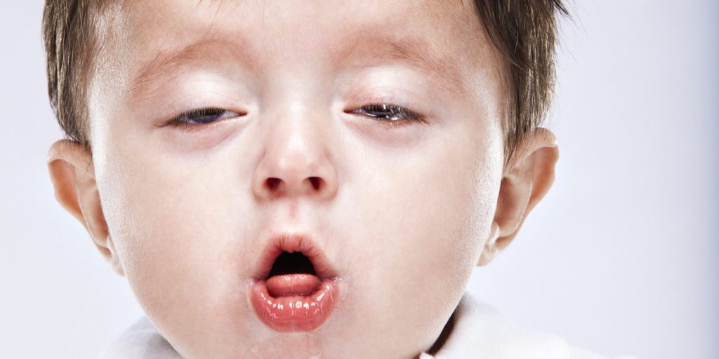 Bayi di bawah usia satu tahun berisiko besar mengalami masalah pernafasan yang teruk dan penyakit yang mengancam nyawa akibat batuk berkahak. 
