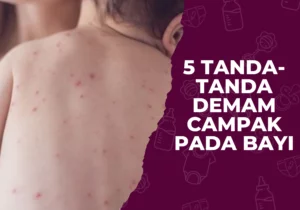 tanda demam campak pada bayi