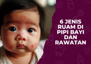 6 jenis ruam di pipi bayi dan rawatan - ruam muka bayi