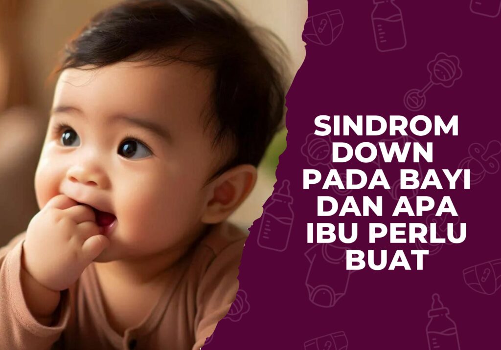 sindrom down pada bayi