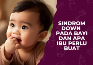 sindrom down pada bayi